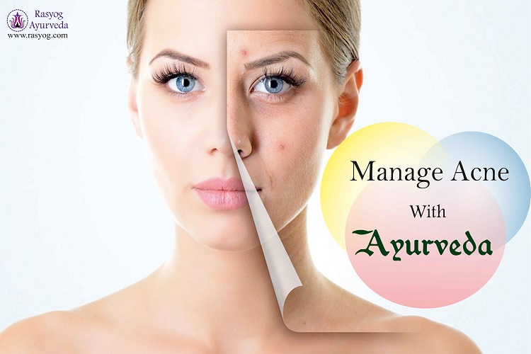 acne cure and medicine