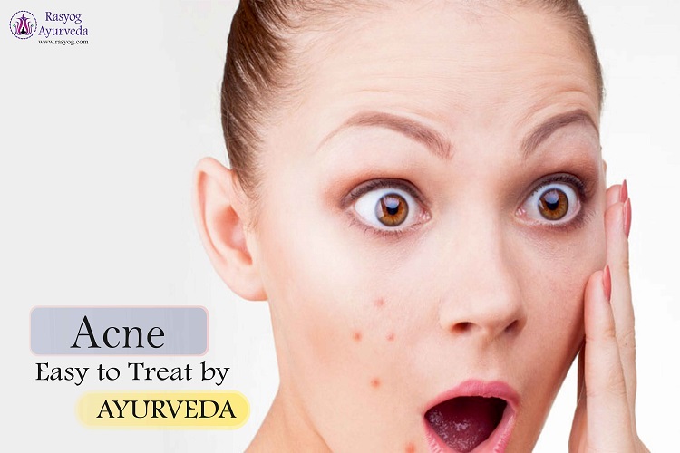 acne treatment