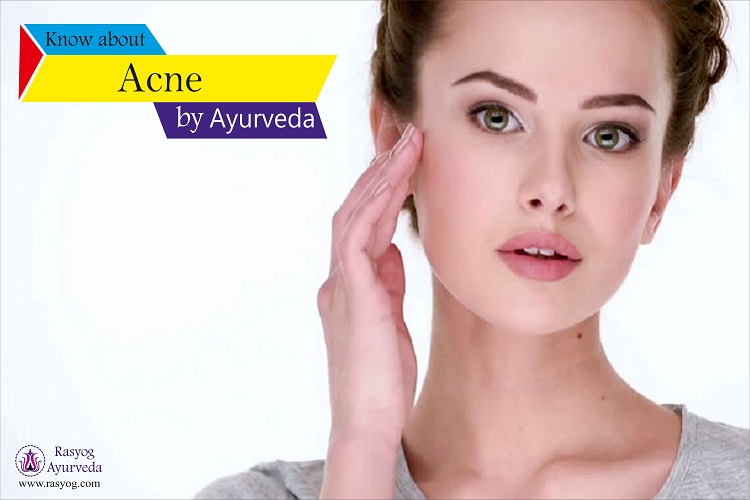 acne cure and medicine