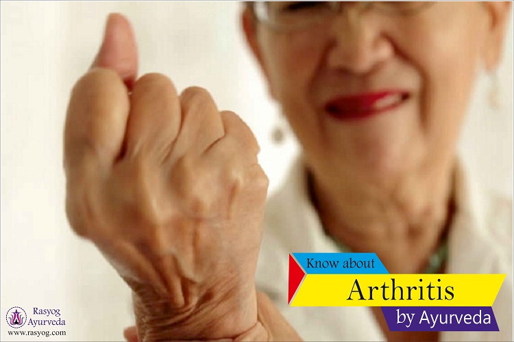 arthritis cure and medicine