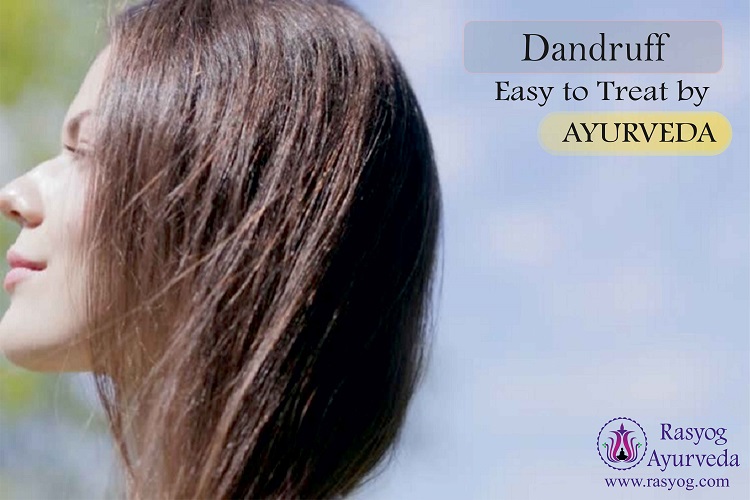 dandruff treatment