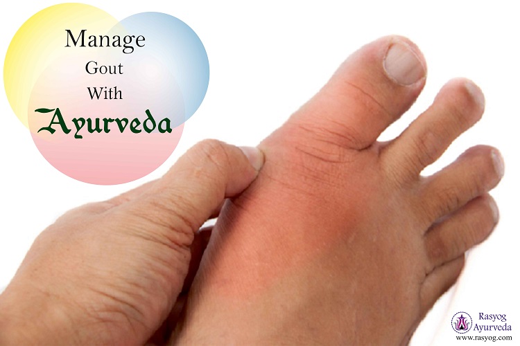 gout cure and medicine