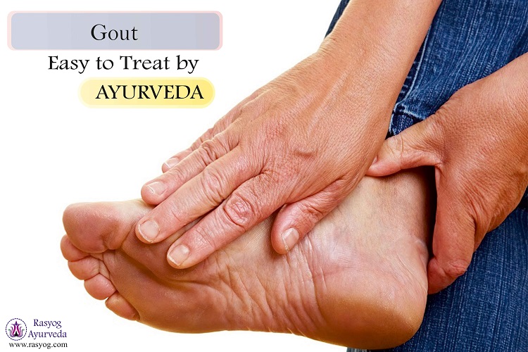 gout treatment