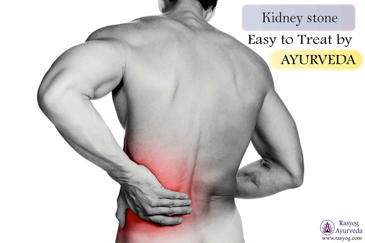 kidney stone treatment