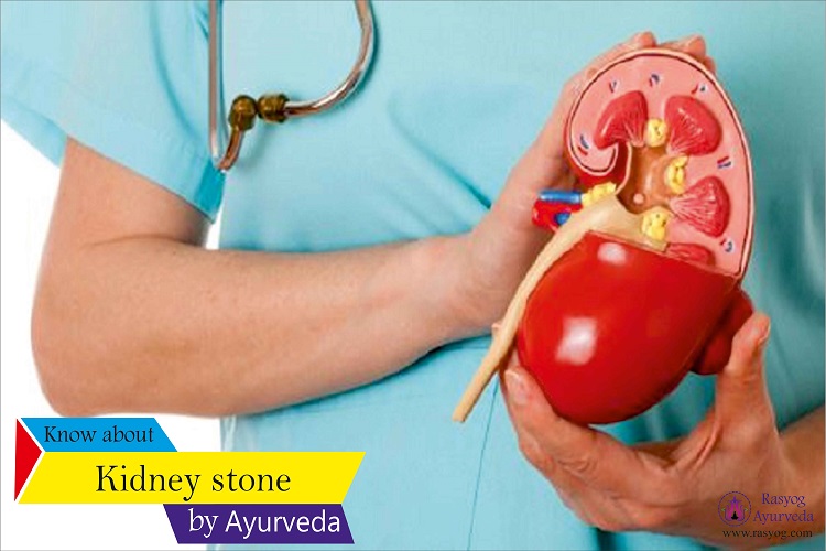 kidney stone cure and medicine