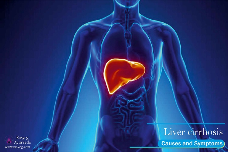 liver cirrhosis causes and symptoms