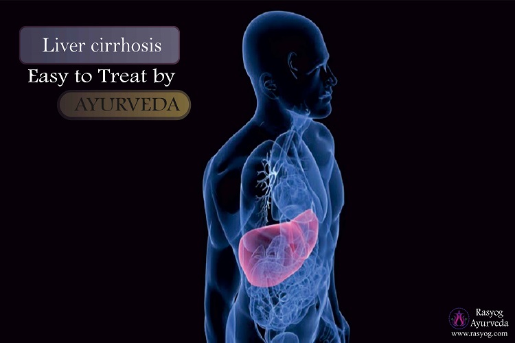 liver cirrhosis treatment