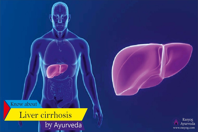liver cirrhosis cure and medicine