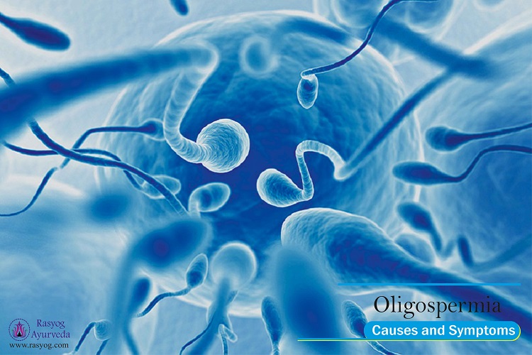oligospermia causes and symptoms