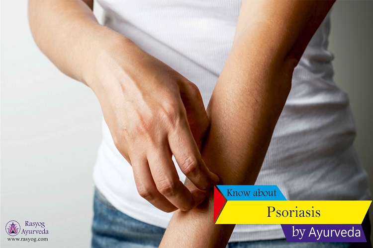psoriasis cure and medicine