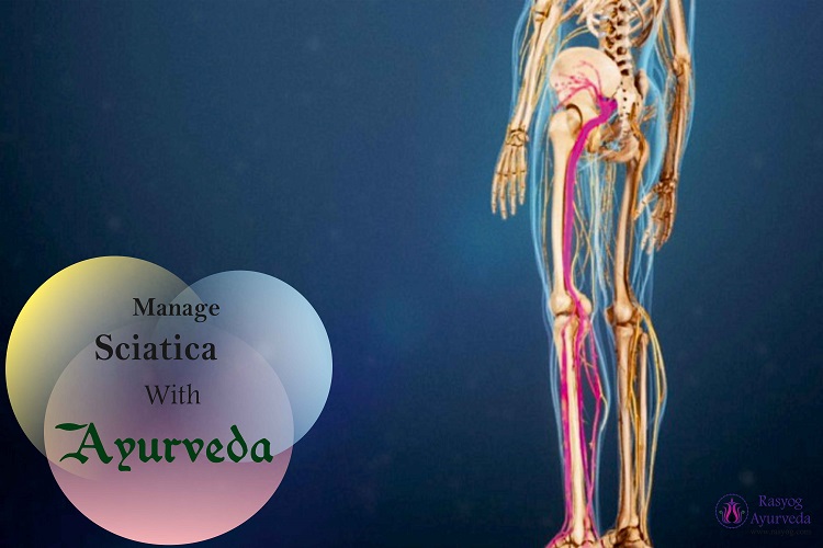 sciatica cure and medicine