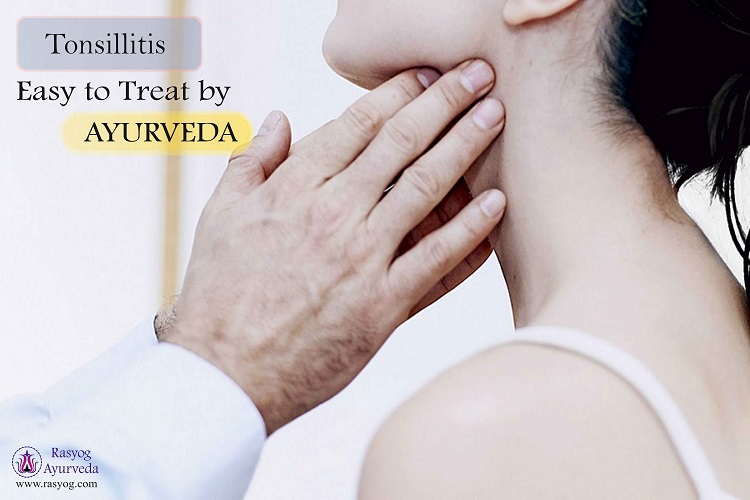 tonsillitis treatment