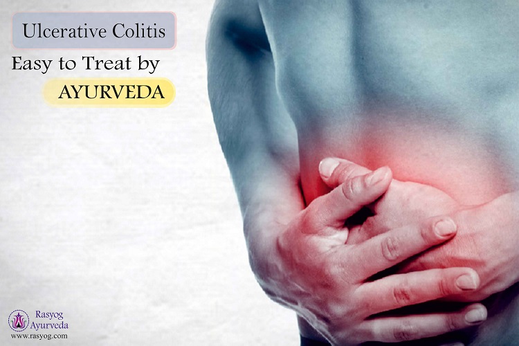 ulcerative colitis treatment