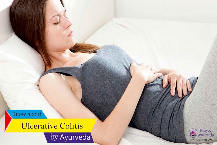 ulcerative colitis cure and medicine