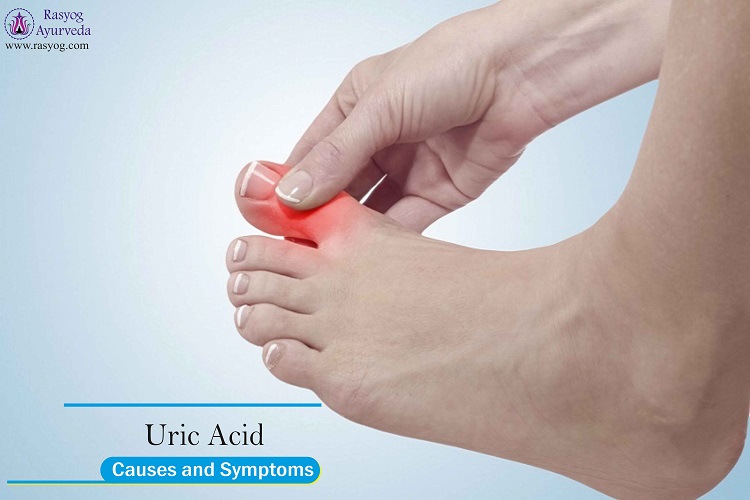 uric acid causes and symptoms